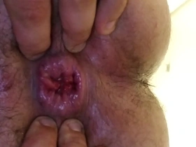 Gay anal gape show